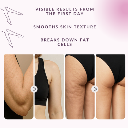 Anti-Cellulite Massager